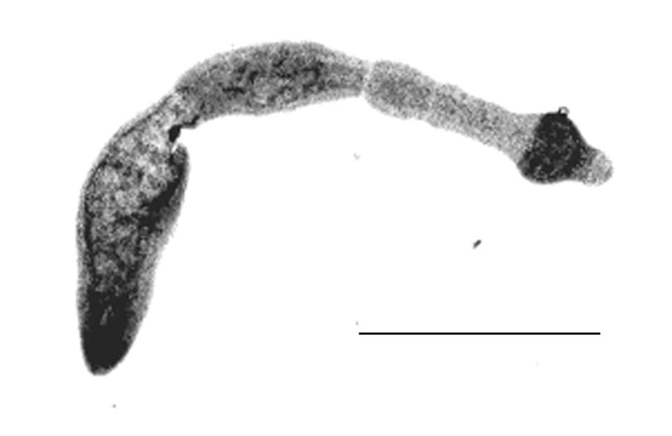 Mikroskopbilde i svart-hvitt av en voksen revens dvergbendelorm med en liten hode med sugekopper, noen få korte ledd og et målestokkstrek på 0,5 millimeter.